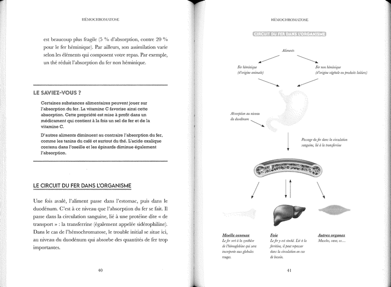 Hémochromatose