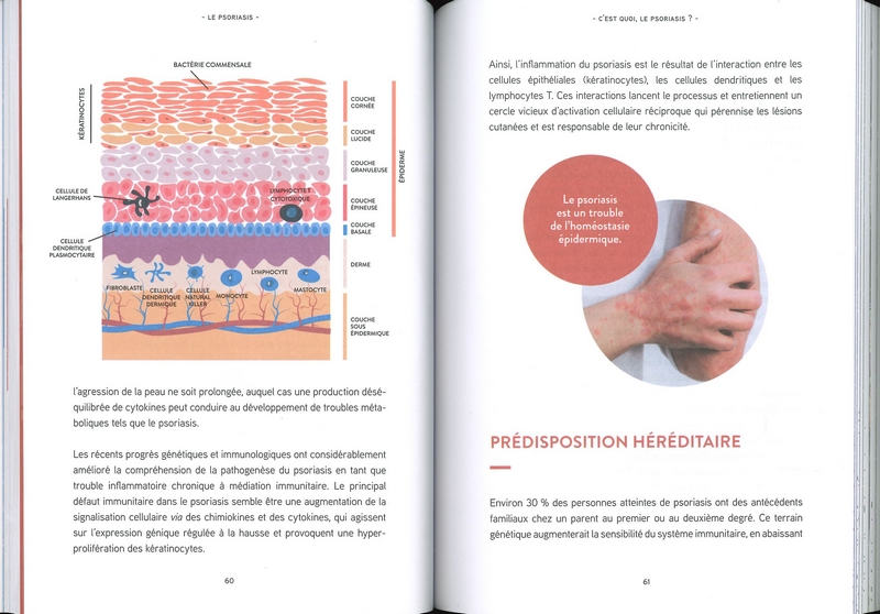 Le psoriasis les solutions naturopathiques