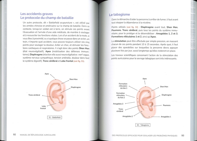 Manuel de réflexologie auriculaire