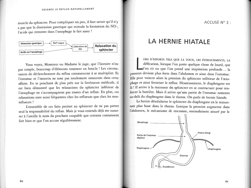 Soignez le reflux naturellement